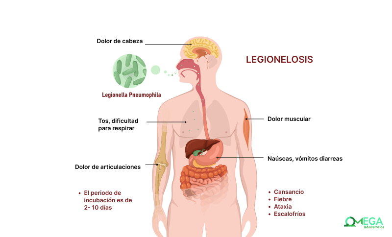 legionella sintomas